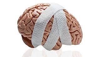 Read more about the article Concussion Part Two: I think I have a concussion, now what?