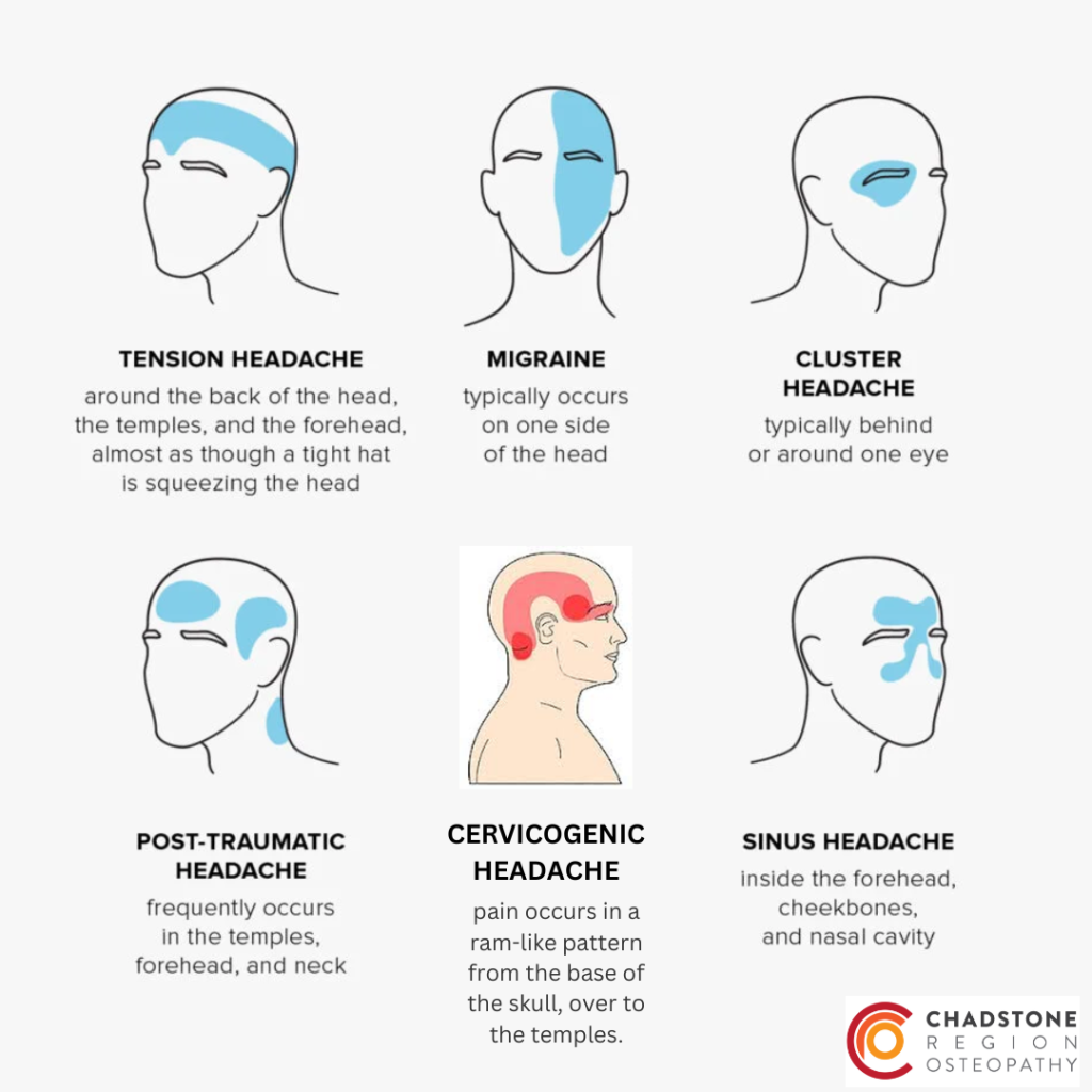 Types of Headaches - Osteopathic Treatment