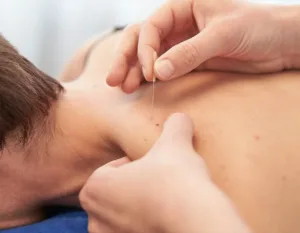Dry needling performed by an osteopath to aid neck pain