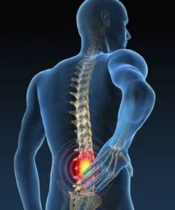 lower back pain caused by sensatisation