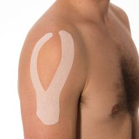 kinesiotape